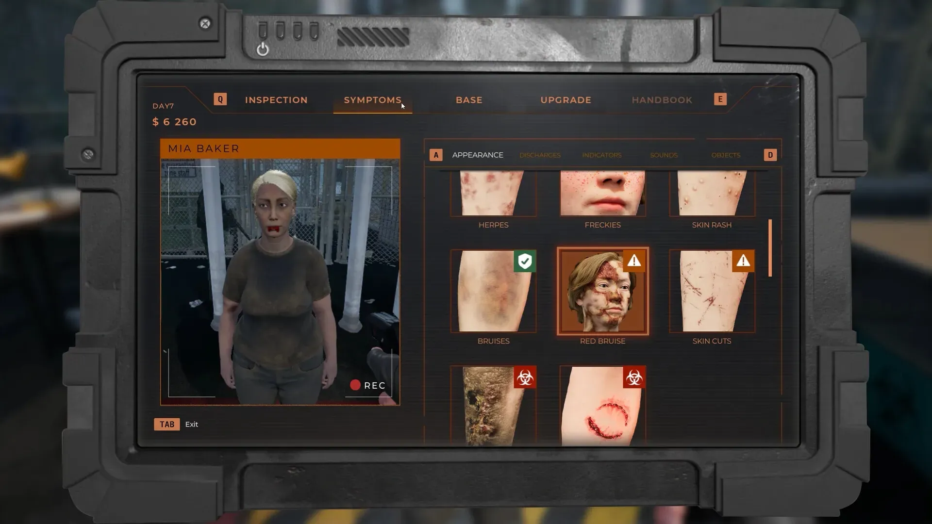 图片[2]-《隔离区：最后的检查》全症状指南